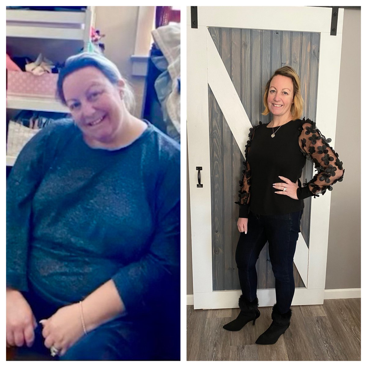 At her heaviest, Jaclyn Catalano weighed 287 pounds at a height of 5 feet 4 inches tall. As the mother of 10 active children, Jaclyn was tired of being the "fat mom" everywhere she went. Click here to read how Bariatric Surgery changed her life smc.health/feelin-good-ag…
