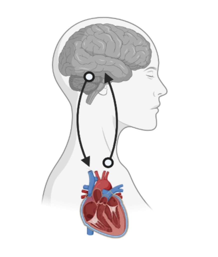 Ever wonder how physical sensations such as a racing heart give rise to fear? Using an adrenaline-like challenge during brain imaging we found that abnormal heart-brain communication contributes to increased fear in women with generalized anxiety disorder…ja.ma/3GmzcSH