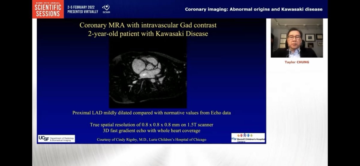 Interesting #SCMR22 Peds/CHD conference talk by Dr. Taylor Chung on Basic principles in Coronary imaging using #whyCMR  which can be useful in Kawasaki pts with coronary aneurysms and in anomalous coronaries.
<a href="/SCMRorg/">Society for Cardiovascular Magnetic Resonance</a> <a href="/scmrchd/">@SCMRchd</a> <a href="/Scmr3D/">SCMR3Dplus</a> 
<a href="/chiarabd/">C Bucciarelli-Ducci</a> <a href="/purviparwani/">Dr. Purvi Parwani</a> <a href="/Kfarooqi/">Dr. Kanwal M Farooqi</a>