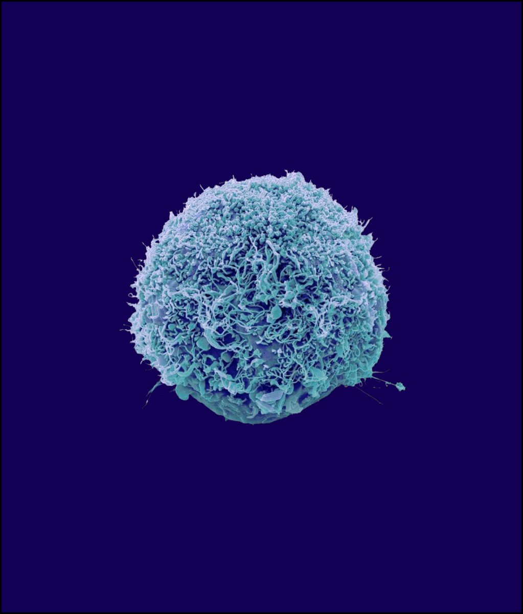 Inception_NFTs's tweet photo. @fancydude8 Get a glimpse into our Scanning Electron Microscopy depictions. Dropping soon on Opensea! Stay tuned. https://t.co/SBKuPLcvlR
