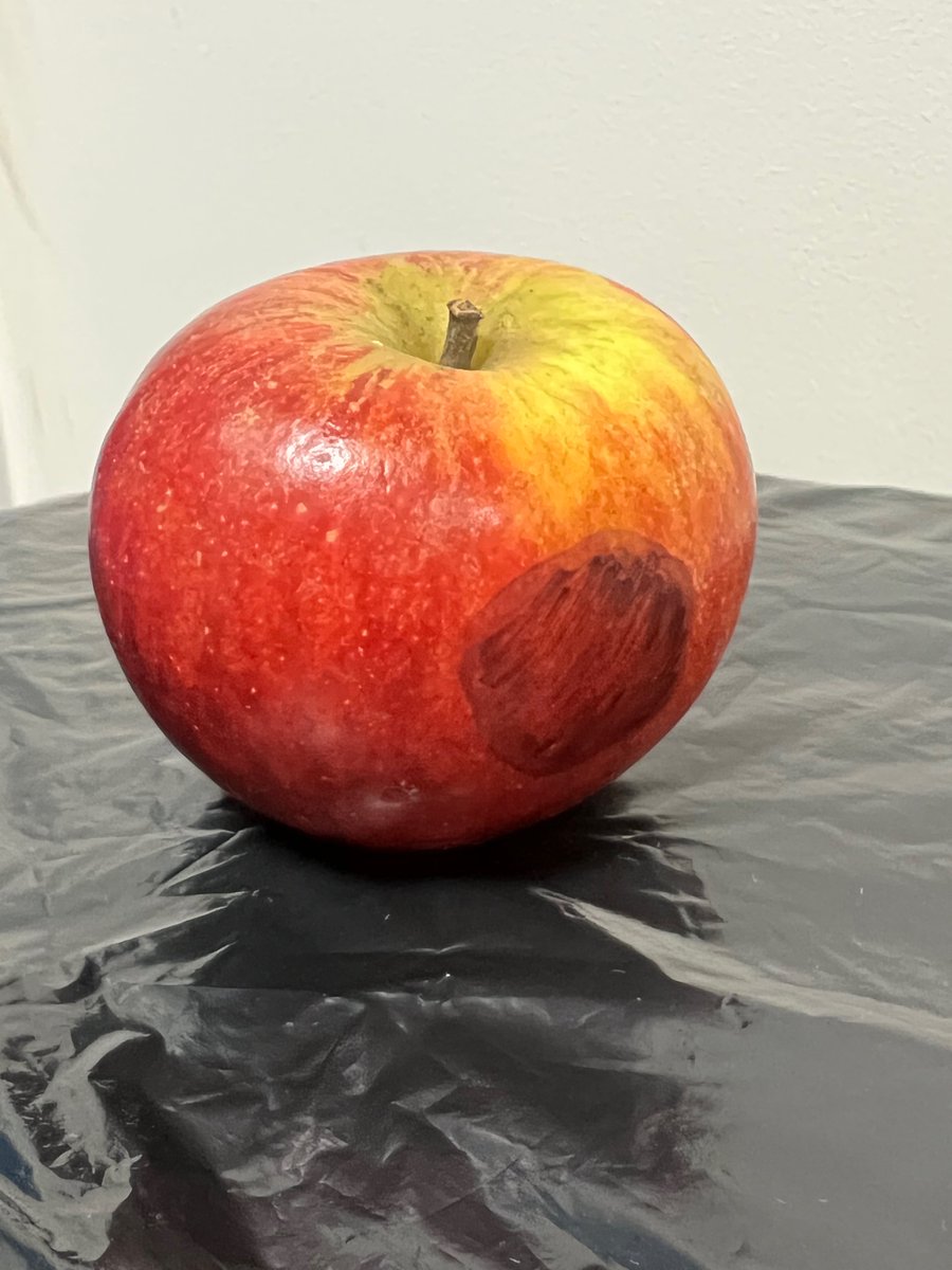 Suspected Deep Tissue Injury- Purple discolouration on intact skin which remains purple after pressing for 5-7 seconds (non blanching). Will be monitored for up to 2 weeks to see if skin damage evolves/breaks down. Diagnosis of Category will be dependent on depth of evolvement