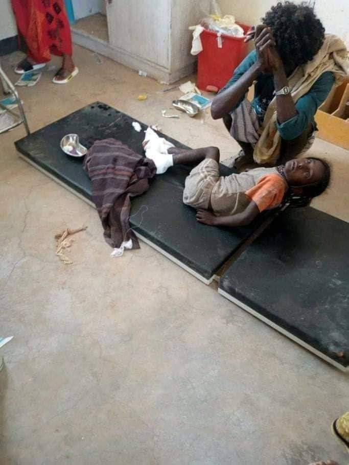 biedo_ali's tweet photo. #Afar_under_attack!
Afar children are being killed and maimed in a terrorist attack by TPLF terrorist junta in the Afar region. The international community should not be silent about it.
#Afar_child_lives_matter π§ https://t.co/AQAkJiwJW9