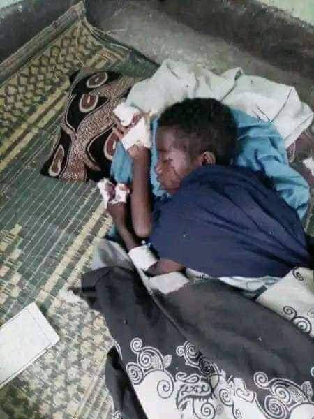 biedo_ali's tweet photo. #Afar_under_attack!
Afar children are being killed and maimed in a terrorist attack by TPLF terrorist junta in the Afar region. The international community should not be silent about it.
#Afar_child_lives_matter π§ https://t.co/AQAkJiwJW9