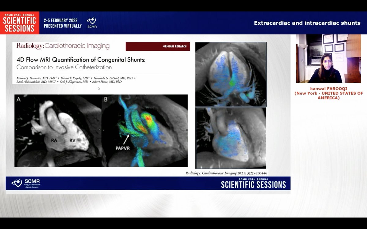 anudodejamd's tweet photo. Terrific talk by @Kfarooqi on #whyCMR for cardiac shunts including beautiful 4D flow imaging @scmrchd @SCMRorg #SCMR22 @PushpaShivaram @DrJenniferCo_Vu @RayRcnita @vineetao17 https://t.co/RJQUTenanA