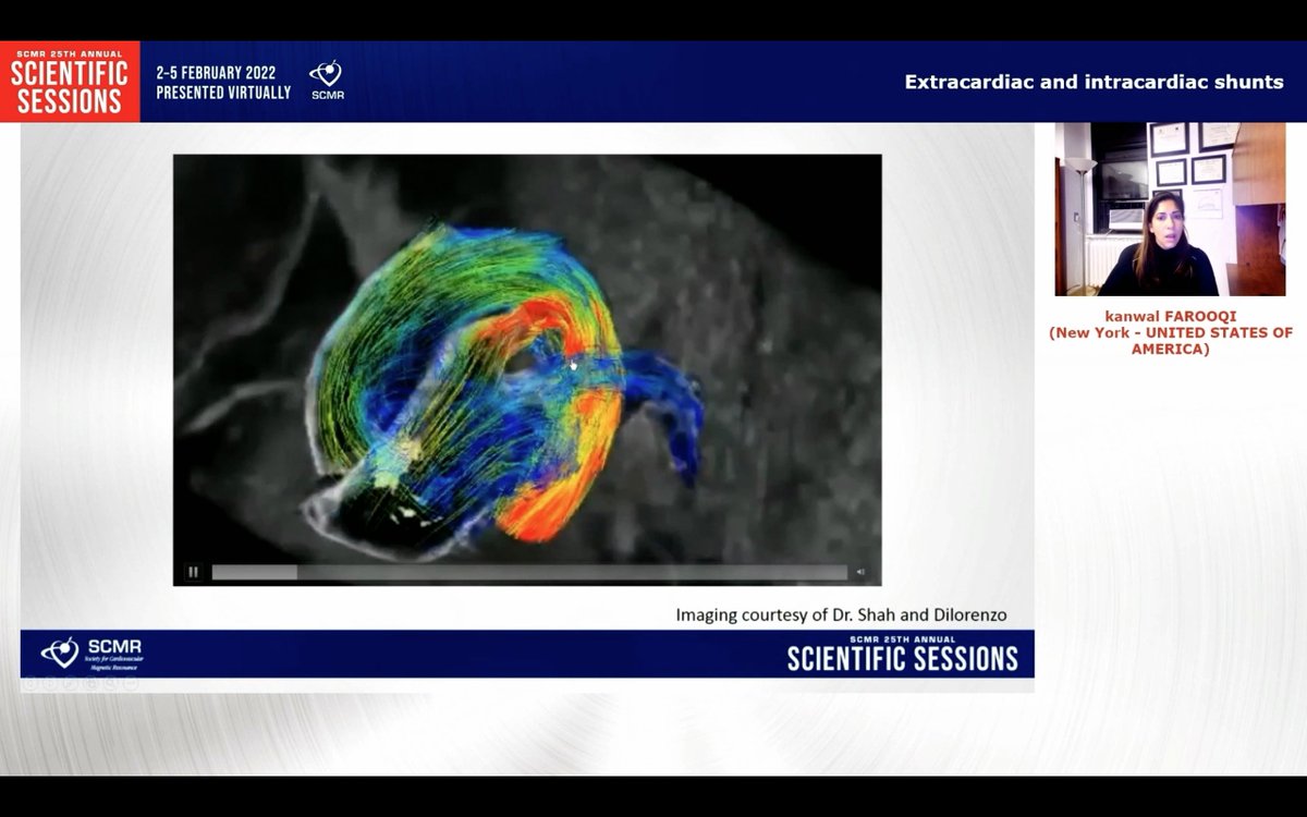 Terrific talk by <a href="/Kfarooqi/">Dr. Kanwal M Farooqi</a> on #whyCMR for cardiac shunts including beautiful 4D flow imaging <a href="/scmrchd/">@SCMRchd</a> <a href="/SCMRorg/">Society for Cardiovascular Magnetic Resonance</a> #SCMR22 <a href="/PushpaShivaram/">Pushpa Shivaram MD FACC</a> <a href="/DrJenniferCo_Vu/">Jennifer Co-Vu, MD, FACC, FAAP, FASE</a> <a href="/RayRcnita/">Nita Ray Chaudhuri, MD, FACC, FSCMR</a> <a href="/vineetao17/">Vineeta Ojha</a>