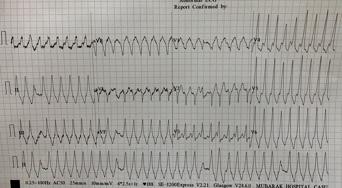ECGs tweet media