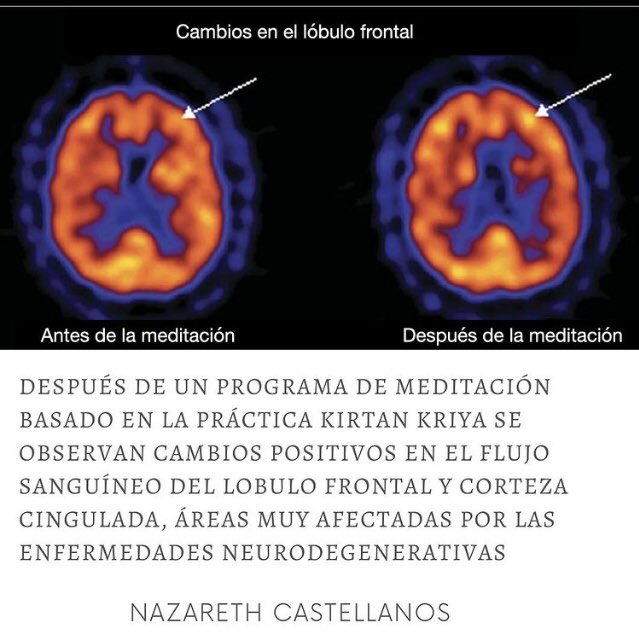 Evidencia cientifica de que la Meditación (Mindfulness) tienen efectos comprobables sobre nuestro bienestar psicoemocional y sobre nuestra neuroplasticidad