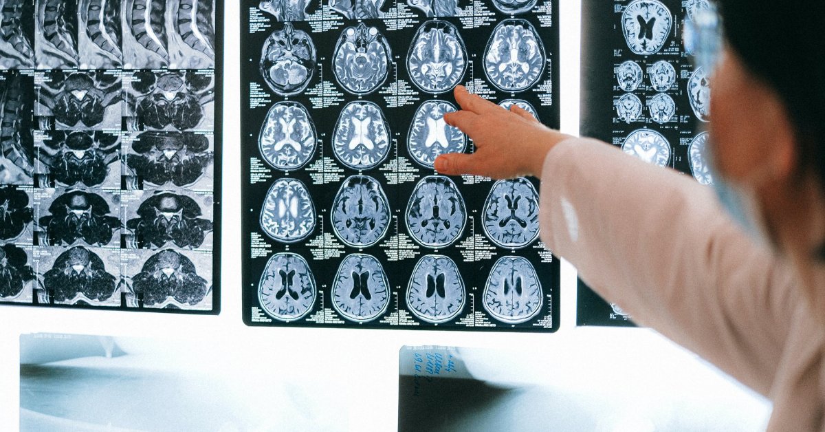 Science and Innovation at Cancer Research UK (@crukresearch) on Twitter photo Are you a graduate, postdoc or early group leader working in paediatric brain tumour research? Apply to attend the CRUK Children's Brain Tumour Centre of Excellence International Summer School, taking place on 11–14 July.
Find out more + apply by 7 March: crukchildrensbraintumourcentre.org/news-and-event… Are you a graduate, postdoc or early group leader working in paediatric brain tumour research? Apply to attend the CRUK Children's Brain Tumour Centre of Excellence International Summer School, taking place on 11–14 July.
Find out more + apply by 7 March: crukchildrensbraintumourcentre.org/news-and-event…
