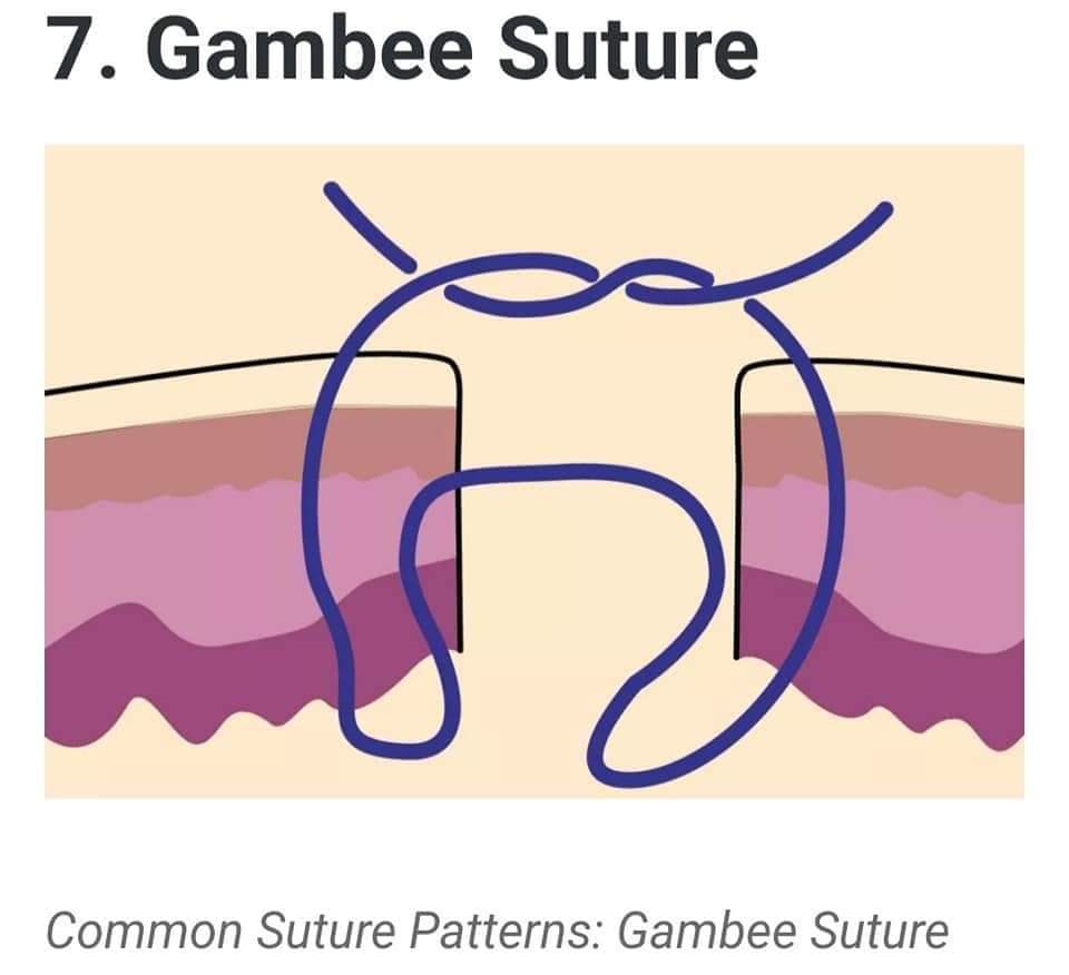 Common Suture Patterns