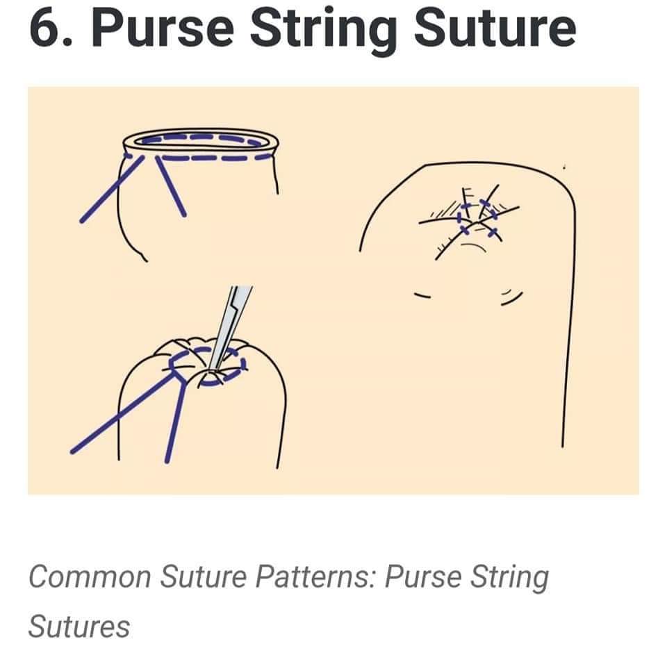Fundamentals Of Sutures, Needles, Knot Tying, And Suturing, 56% OFF