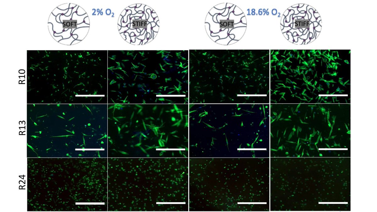 ExtracellMatrix's tweet photo. A research team at @UCL, led by Drs. @AgataNyga and @UmberCheema, developed renal #tumoroids, allowing for the culture of patient-derived cancer cells in 3D #microenvironment and investigation of cell-#matrix interaction.

https://t.co/fHxFkZ3WOO https://t.co/rv3i19DNAb