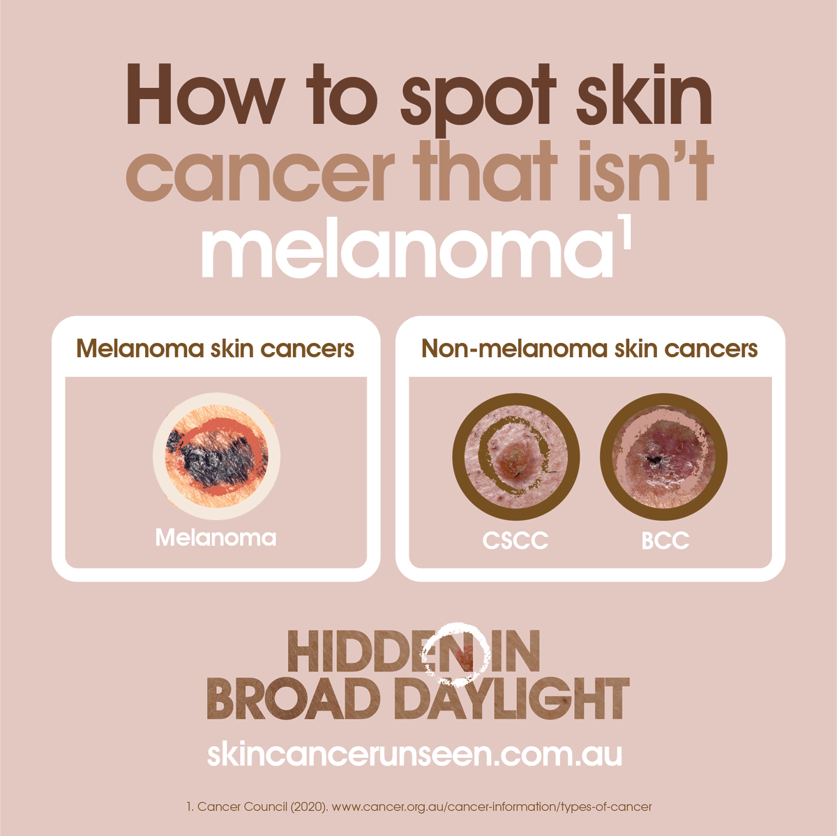 SanofiANZ's tweet photo. Did you know that #skincancer that isn’t #melanoma can also be life-threatening if it becomes advanced? 

This #WorldCancerDay find out more at https://t.co/83d05PuGQP or speak with your healthcare professional. 

#SkinCancerUnseen #HiddenInBroadDaylight #melanoma https://t.co/VW5PY3t33H