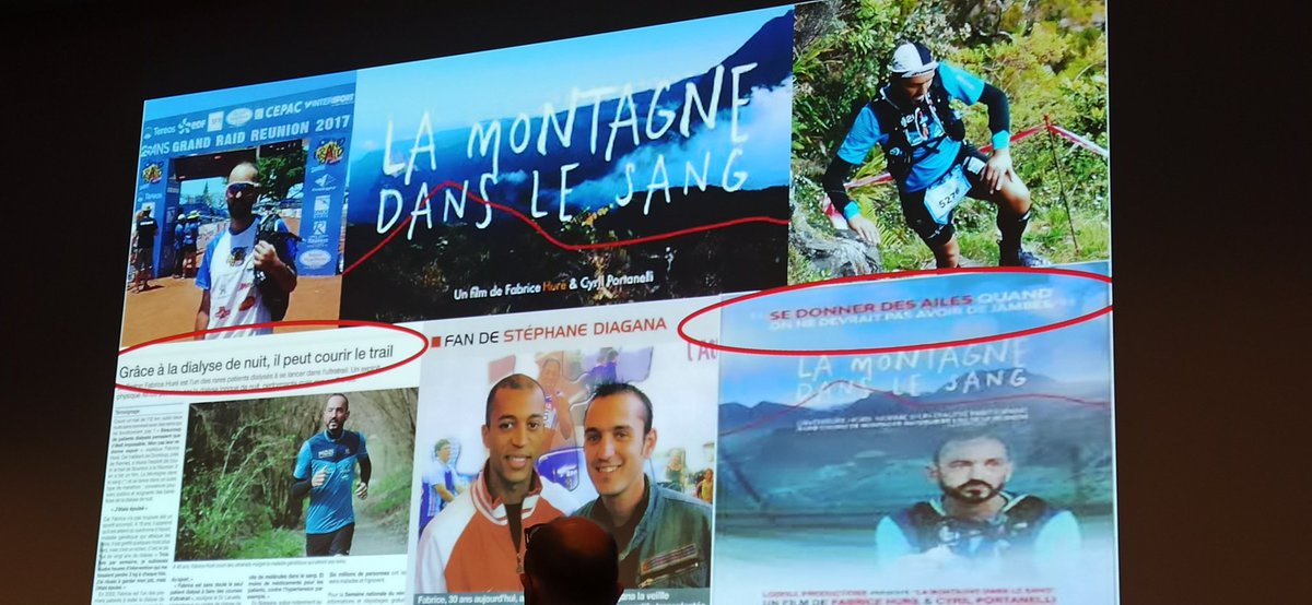 LMDSlefilm's tweet photo. TÉMOIGNAGE 🤩
L'hemodialyse longue nocturne, le meilleur témoignage 👇
Toujours Adapter la modalité #dialyse au projet de vie des patients.
Le patient est dans la métropole Bordelaise, @ChristianCombe @yannbubien @ARS_NAquit un projet dans ce sens à Bordeaux ? #aurad #chu #pbna https://t.co/eFea8E7fMQ