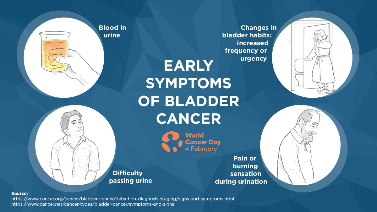 Cxbladder on X: Do you know the early signs of bladder cancer? When  detected at an early stage, bladder cancer can usually be treated  successfully. If you have concerns, speak to your