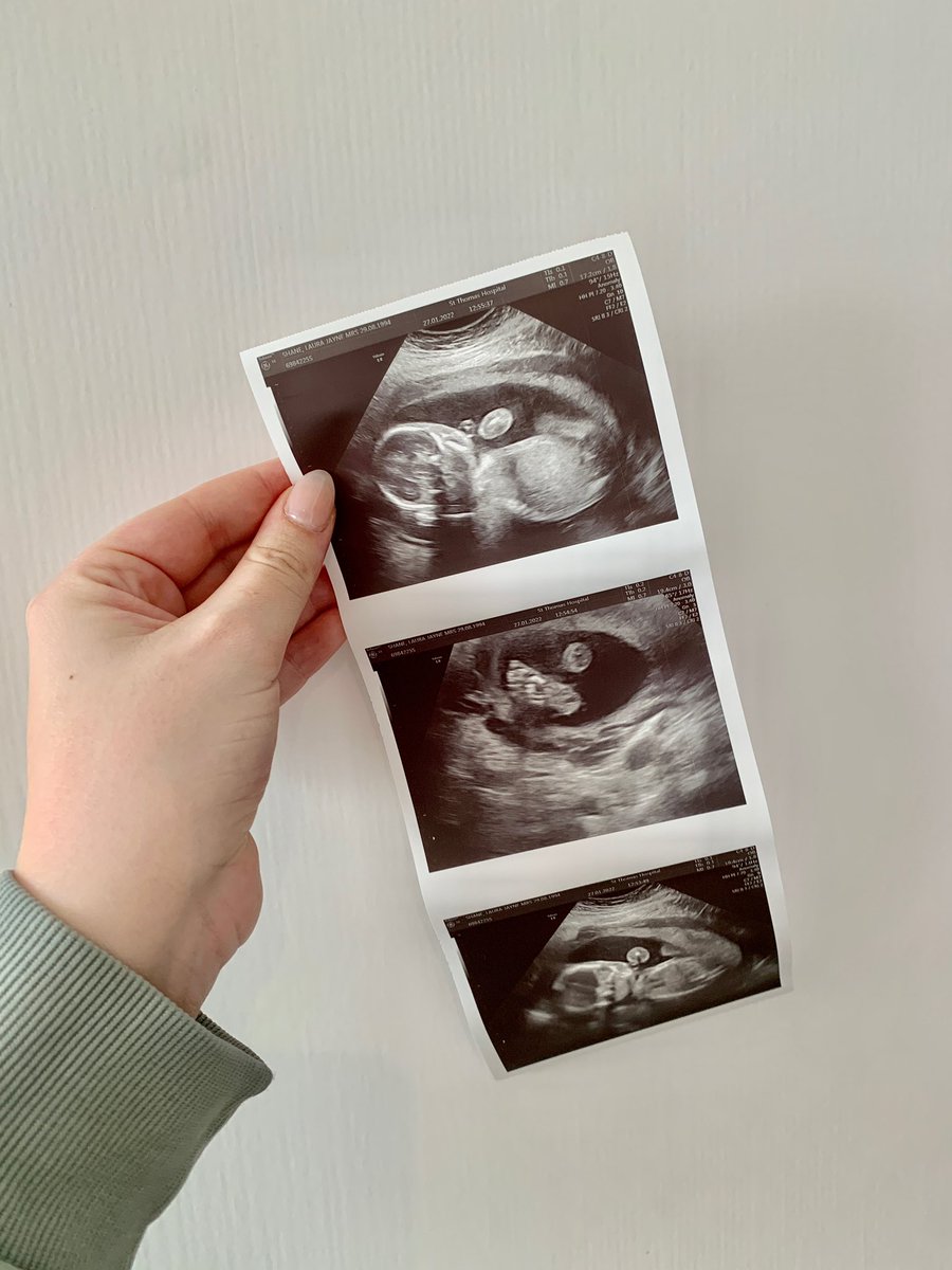 Our baby girl 😊❤️