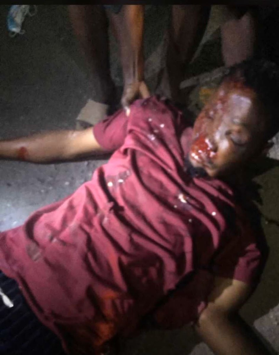 HectorManlike's tweet photo. This is the 3rd accident today at akungba akoko the host town for Adekunle Ajasin university and the 5th since the beginning of February.

Is this how we will keep loosing our dear brothers and sister to truck accident everyday?
@SaharaReporters
@ARISEtv

#saveaaua
#saveaaua https://t.co/rydXeetKa8