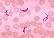 Aşılarda bulunan parazitler: -Microfilaria: Pfizer marka 50 dozluk şişenin 15'inde, Moderna 35/50. -Toxoplasma gondii: Moderna 28/50, Pfizer: 8/50, AstraZeneca: 32/50. -Trypanosoma brucei: Moderna'da: 12/50, Pfizer: 38/50, AstraZeneca: 22/50 ve genetiği değiştirilmiş farklı+++