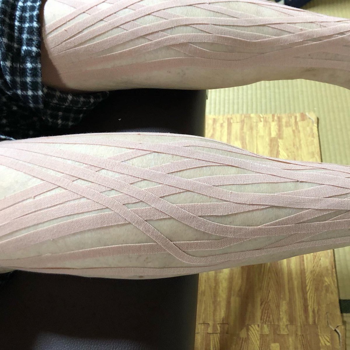 yamasitaseitai's tweet photo. 【足のだるさに対するテーピング】

仕事中立ちっぱなしで足が疲れて怠いという症状を訴えの70代男性のお客様。

↓施術後

✅足の疲労感がなくなった
✅足がとてもスッキリしている
✅足がとても軽い
と仰られていました✨
#岡山県
#出張整体
#筋膜リリース
#疲労回復 https://t.co/JDcrG01FrD