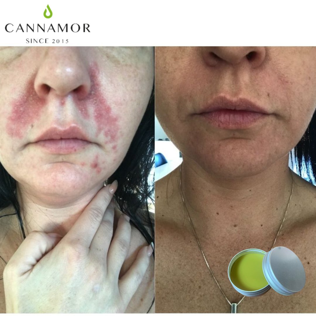 Cannamor-Wholesale (@thedreamherb) on Twitter photo Healing Balm 50ml
The package is now changed for nice frozen glass what gives a healing balm elegant look.
laura@cannamor.dk
cannamor-wholesale.com
#cbd #cbdproducts #cbdoil #cbdhealth #hemp #hempoil #hempoils #hempproducts #cbdskincare #cbdskincareproducts #cbdskincarecompany Healing Balm 50ml
The package is now changed for nice frozen glass what gives a healing balm elegant look.
laura@cannamor.dk
cannamor-wholesale.com
#cbd #cbdproducts #cbdoil #cbdhealth #hemp #hempoil #hempoils #hempproducts #cbdskincare #cbdskincareproducts #cbdskincarecompany