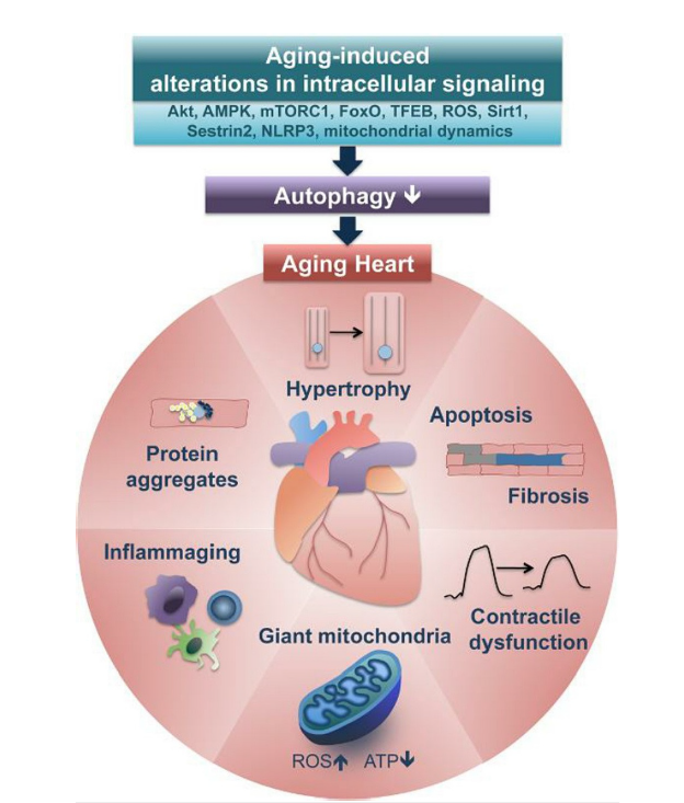 EstebanDL's tweet photo. ¿Por qué envejece el corazón y nuestras arterias?

¿Podemos hacer algo?

Durante años nos quedamos mirando emocionados, significancias estadísticas limítrofes y la enfermedad cardiovascular nos sigue castigando...

Miremos para otro lado
HILO https://t.co/ZXsD9bbjyS