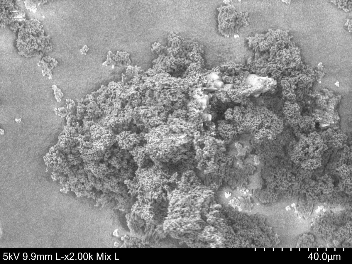 soilplastics's tweet photo. Always wanted to know what #microplastic looks like under an electron microscope? 😍 Conventional #LDPE & biodegradable #PBHV on a scale we don't get to see every day! 😲🤓 This really puts into perspective how small #plastic can be in our environment, often invisible to us. https://t.co/Jg3seqFOcI