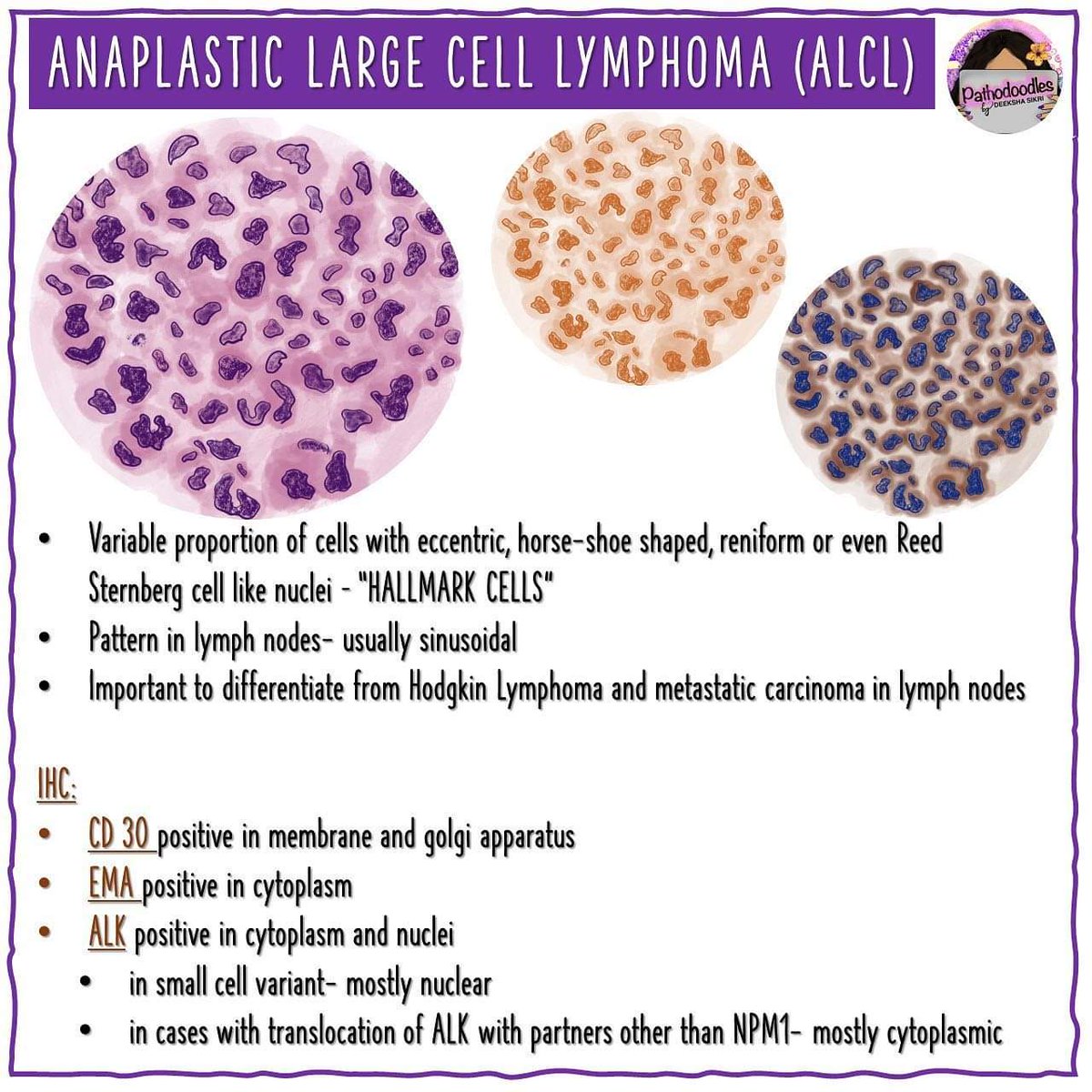 #MedStudentTwitter and #PathTwitter 

Haaaaave you met ALK ? 

#pathodoodles #ihc