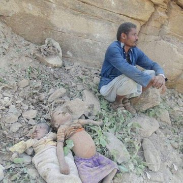 (Ameen Aljermozi) 🇾🇪 أمين الجرموزي tweet media