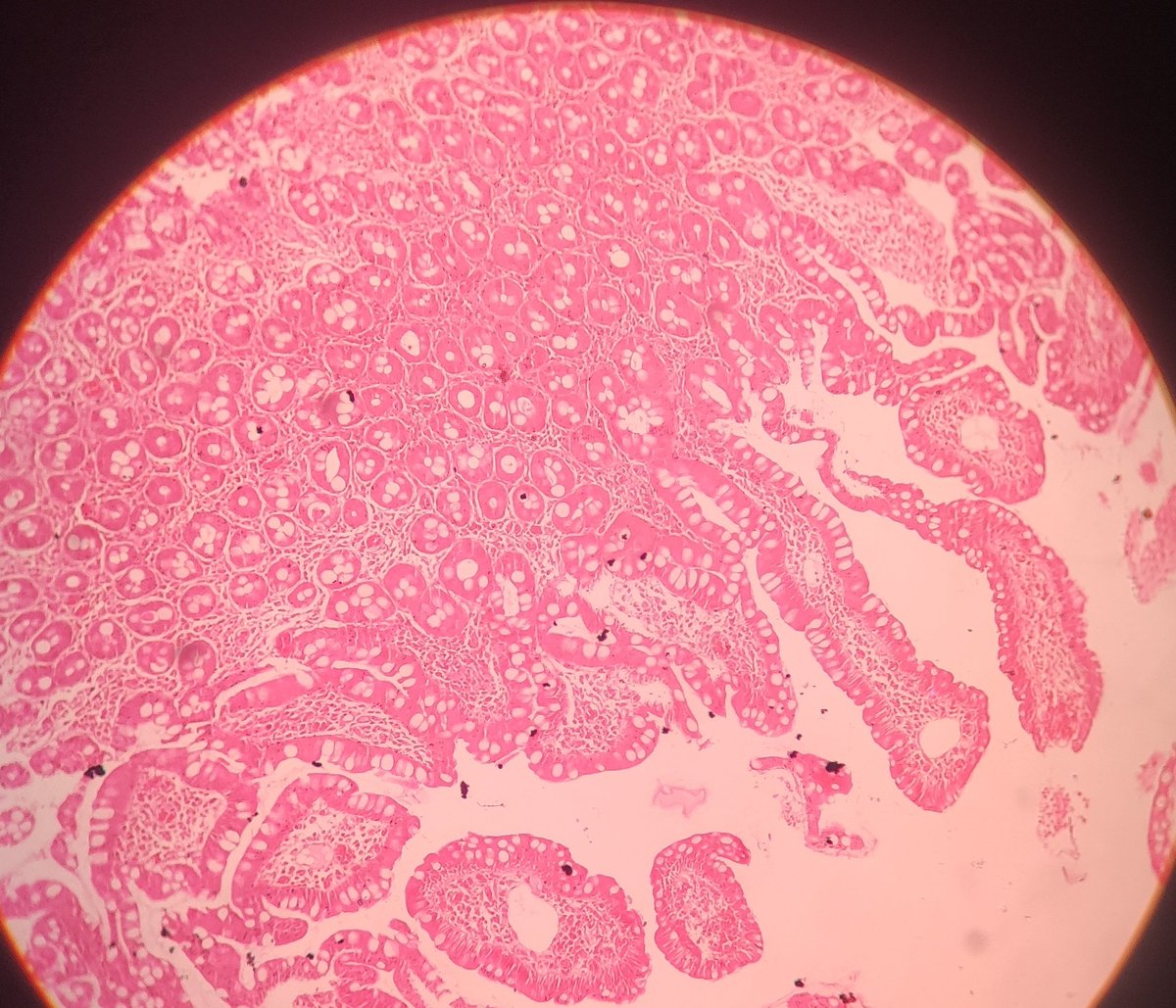 TrishaBanik9's tweet photo. 48y Female, C/O dysphagia, gastric biopsy. #GIpath
D/d https://t.co/3cBSFcnars