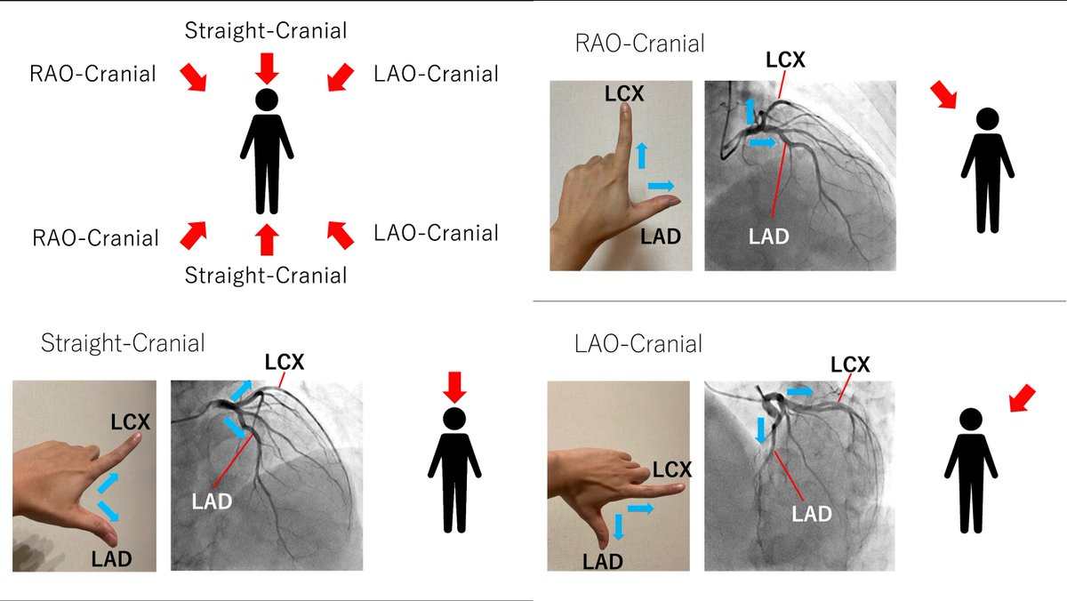 Runfun Jb Runfuno Twitter Runfun Jb Runfuno Twitter