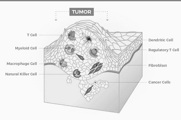 LabTestDotNg's tweet image. Cancer

A disease in which abnormal cells divide uncontrollably and destroy body tissue.

MOST COMMON TYPES

Breast cancer

Prostate cancer

Basal cell cancer

Skin cancer (melanoma)

Colon cancer

Lung cancer

Leukemia

Lymphoma

Early detection helps in treatment &amp;amp; outcomes.