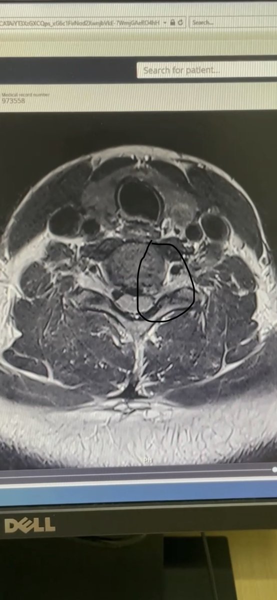 اسعد الله مساكم 
انا اعتذر من الاخوان اللي يرسلون لي بالخاص لتدهور وضعي الصحي 
يعلم الله اني من فتره اعاني من هذا الشي الى ان وصل بي الحال اني لا استطيع ان احرك يدي اليسار ولا استطيع النوم او الراحه الا بمسكنات قويه ولاتنفع معي احيان 
لذلك لاتنسوني من دعائكم ف انا ب امس الحاجة له