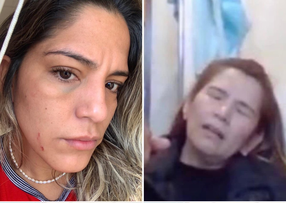 caroriberanez's tweet photo. Esta es la prueba de abuso y agresión de los “machos” políticos en el gobierno contra una hija que quiere el bien para su madre. Arce, Evo y Del Castillo son socios de tortura y agresiones hacia la mujer. No sorprende ya que el país entero sabe que en sus hogares hacen lo mismo. https://t.co/bfTZsxCdYj