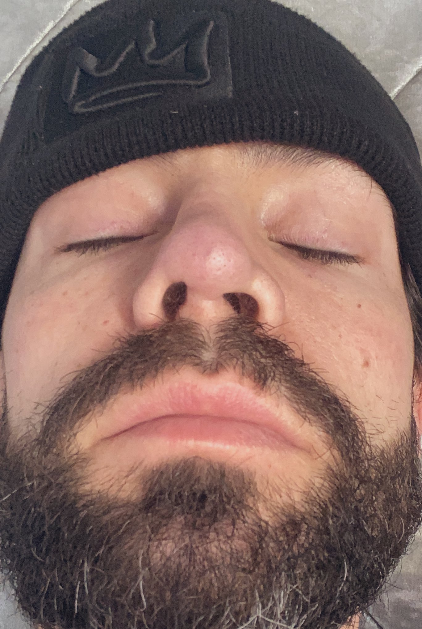 Uneven nostrils deals