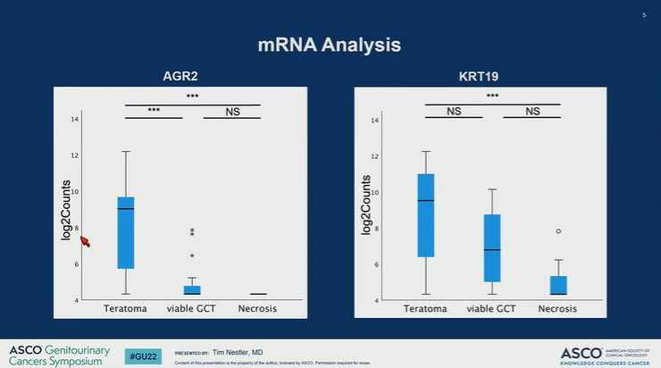 DrChoueiri's tweet photo. Great presentation by Tim Nestler @UniCologne on the value of differentially expressed mRNA and proteins in the diagnosis of GCTs and teratomas vs. necrosis in pcRPLND
@ASCO #GU22

@OncoAlert https://t.co/PGOBx29br6