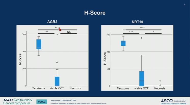 DrChoueiri's tweet photo. Great presentation by Tim Nestler @UniCologne on the value of differentially expressed mRNA and proteins in the diagnosis of GCTs and teratomas vs. necrosis in pcRPLND
@ASCO #GU22

@OncoAlert https://t.co/PGOBx29br6