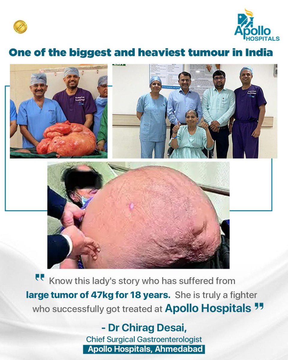 JanakiDr's tweet photo. Dr Chirag Desai and team at Apollo Hospital Ahmedabad did a challenging surgery and removed probably the biggest and heaviest(47 kg) tumour of India.  A 56 year old lady has recovered completely. 

#worldslargesttumour #largest #surgery #ApolloHospital #drchiragdesai #success https://t.co/UpSJtxfn9y