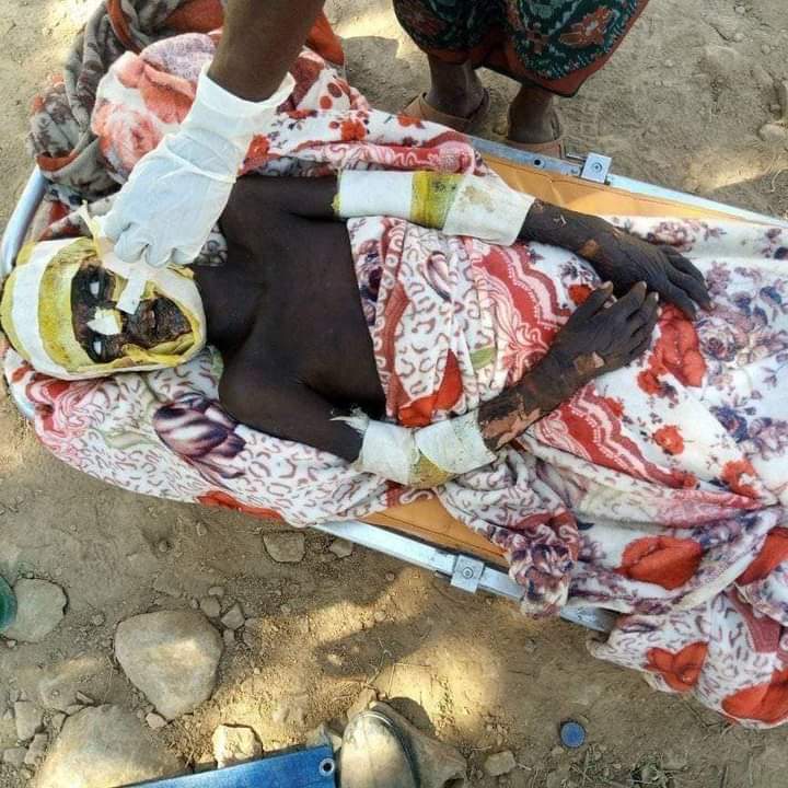 NurTahir3's tweet image. If z international community &amp;amp; UN organizations r concerned about z humanity,zey must condemn z genocide being committed by #TPLFTerroristGroup against Afar pple in Zone2. Stop Double standard #AfarUnderAttack  @amnesty  @SCRtweets @UN_HRC @antonioguterres @EU_Commission  @POTUS