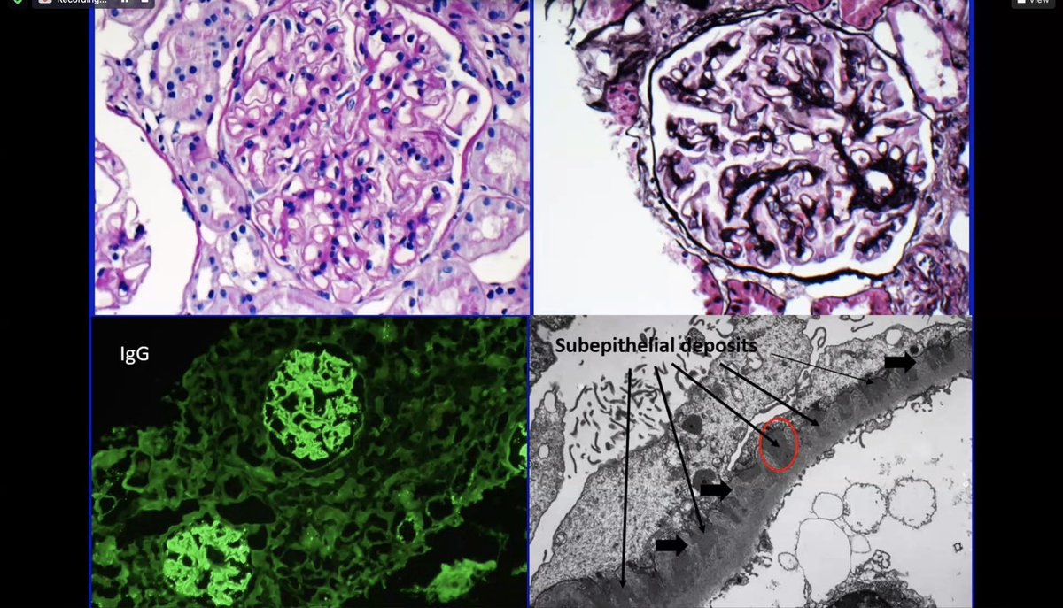Sayna Norouzi, MD, FASN tweet media