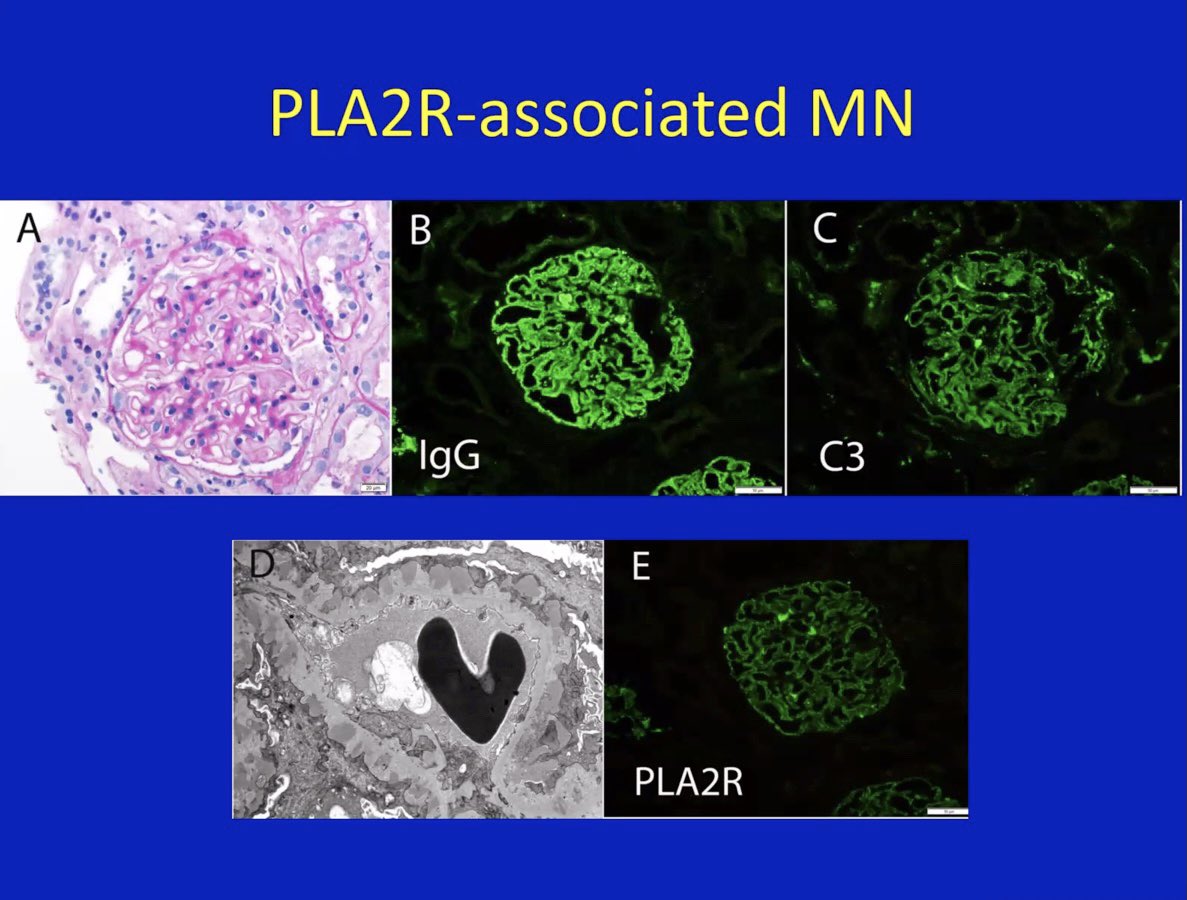 Sayna Norouzi, MD, FASN tweet media
