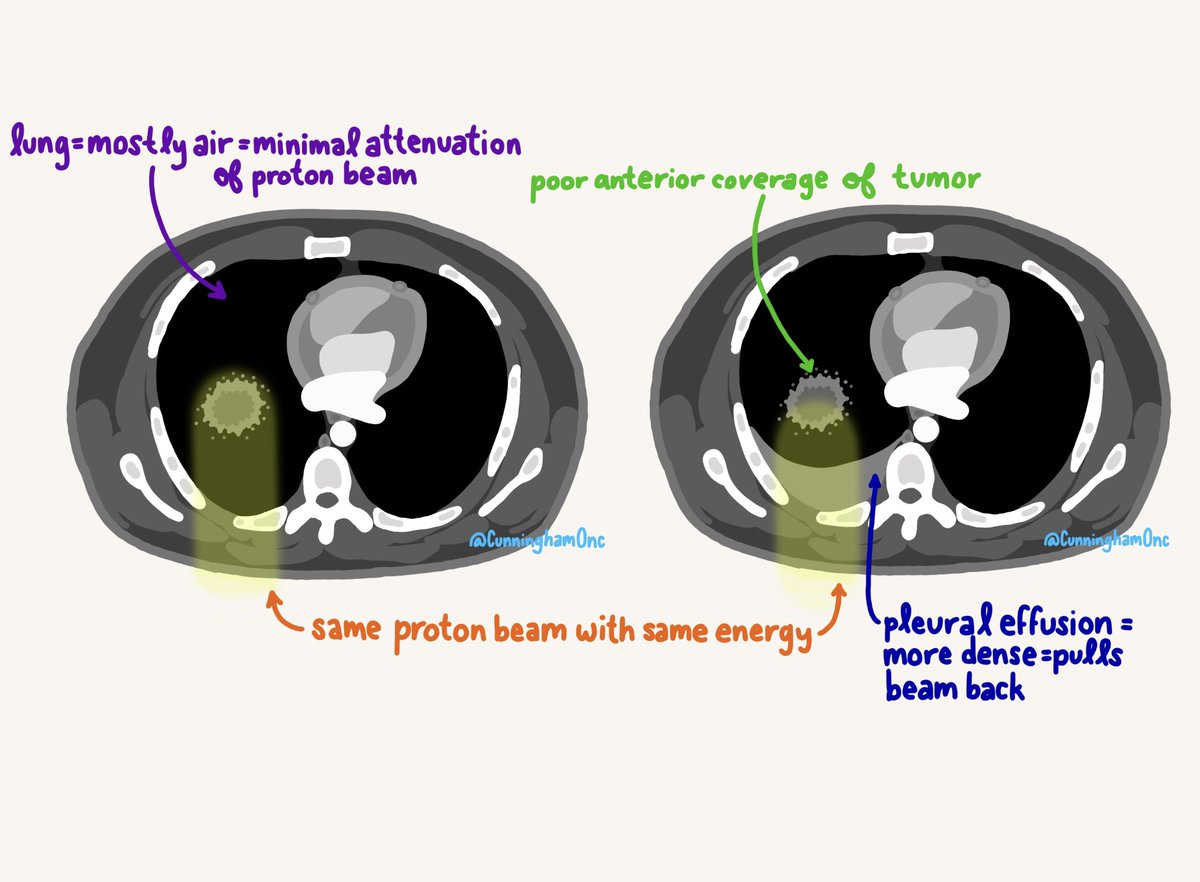Simplified illustration showing how changes in the proton beam path can impact dose distribution #protons <a href="/PTCOGNA/">PTCOG-NA</a> #radiation #medphys #roedu #RTT #MedEd