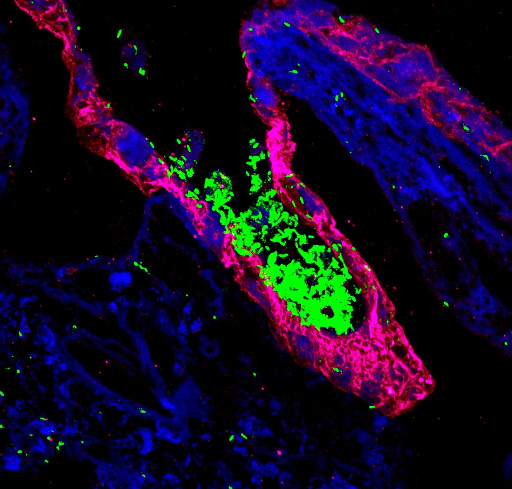 We are hiring 🙂:
PhD student position to work on "3D Tissue Models for Studying Infections by Gastrointestinal Pathogens" 👇
imib-wuerzburg.de/fileadmin/user…

imib-wuerzburg.de/career/