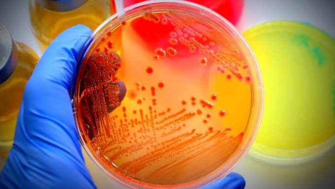 AGRORUM's tweet photo. Hemos vuelto al #HiloDeLosJueves 👀🧠con un tema que nos han pedido mucho 

⬇ ⬇ ⬇ ⬇
📢👩‍🔬¡Análisis Microbiológicos! 

¿Qué son? ¿Para qué sirven? ¿Quiénes lo deberían realizar?

Hoy en #Agrourm te explicamos todo lo que tienes que saber sobre los análisis microbiológicos👇 https://t.co/s0ea9o08hA