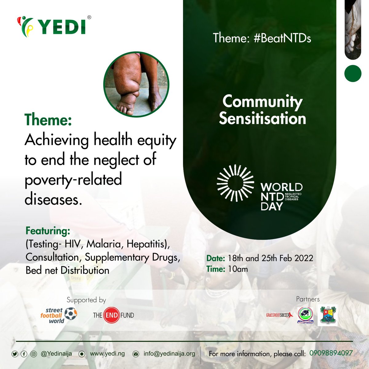 yedinaija's tweet photo. Tomorrow, we will be at Mile 12 central CDA secretariat, Olatunji Ajanikoko Street, off Maidan road by 10am. Do you know anyone living around this area? Please share with them.
#NTDs #neglectedtropicaldiseases #WorldNTDday #awareness #sensitization #ENDfund #beatNTDs #yedinaija https://t.co/HDQ6pPq9rE