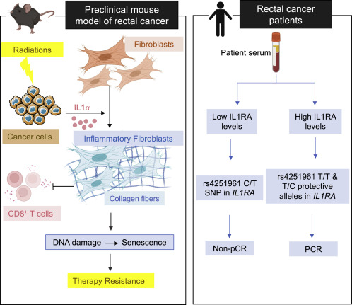 Inflammatory fibroblasts make rectal cancer resistant to radiation therapy dlvr.it/SK9QzN