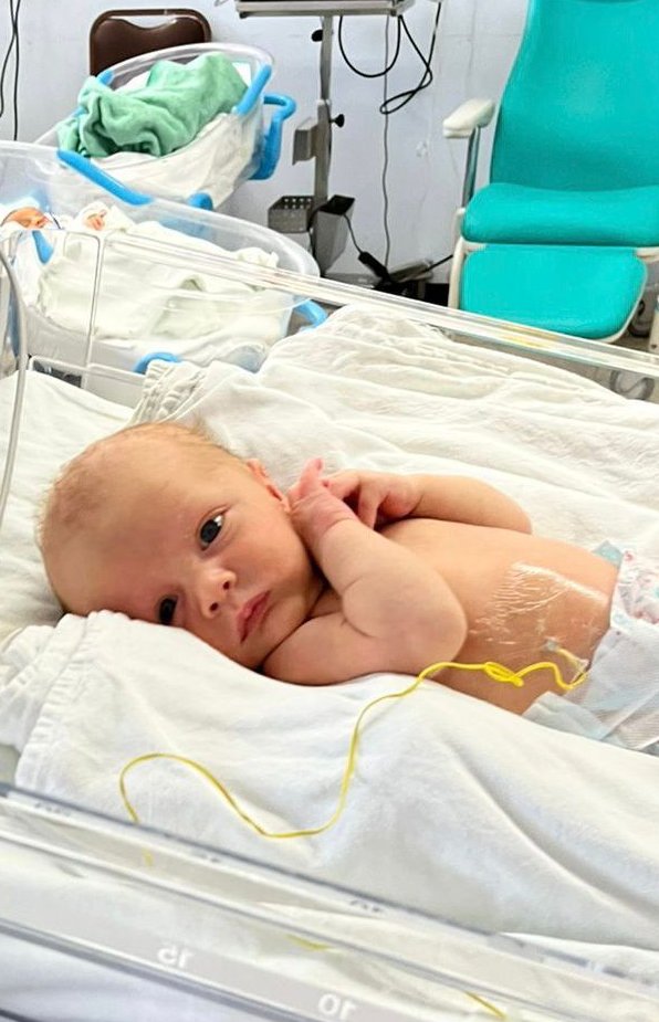 Estábamos seguros que mi sobrino tenía algo serio. Nació hace menos de 1 mes, nunca llora, cuesta demasiado despertarlo para que coma y ha tenido episodios que parecen convulsiones 3 veces (1/4)