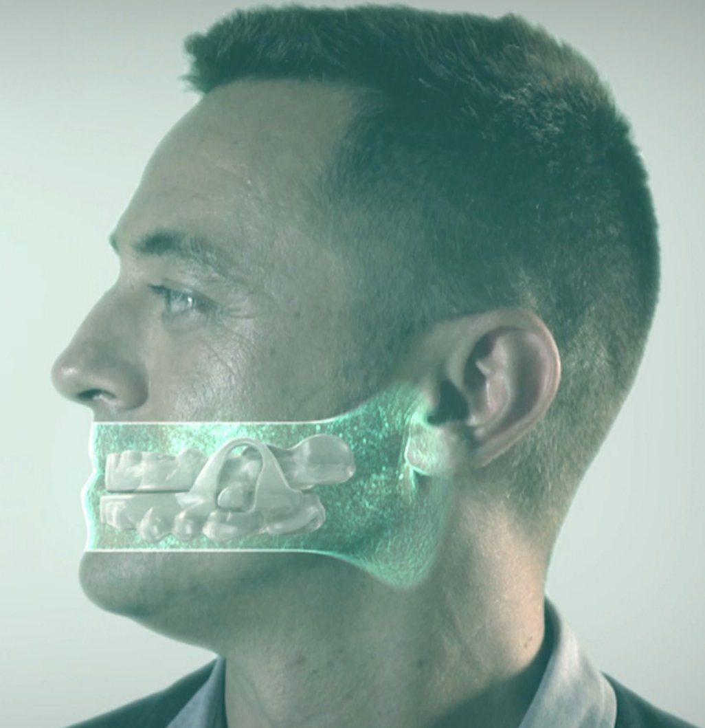 ClnicaBowen's tweet photo. #NOA de @OrthoApnea, el mejor dispositivo del mundo para tratar el #ronquido y la #apnea del sueño 💤

Infórmate sin compromiso en el 📱 91 399 27 30 https://t.co/vJ5DVxihU8