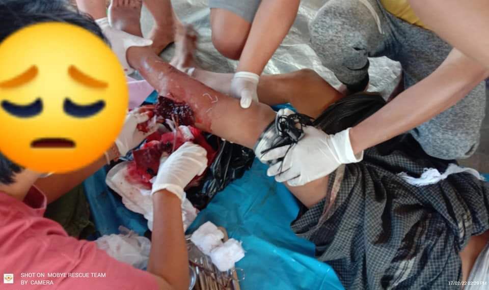 harleythel's tweet photo. Junta soldiers shot at a truck that came into Moebye town, resulting in injuring at the leg of a man from the truck, reportedly. #2022Feb18Coup #GlobalArmsEmbargo #WhatsHappeningInMyanmar https://t.co/L92Hx1LaST