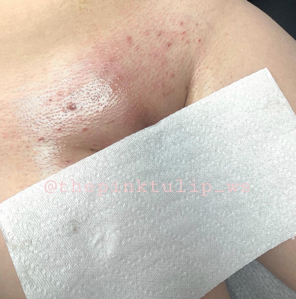 Itzelt_Guevara's tweet photo. So happy to announce my new business! I’m a full body waxer with 4 years experience &amp; any retweet could be my next client so show some love💖 Tell your besties to come to ThePinkTulip &amp; we’ll get them ready for the upcoming summer😛 Follow my Insta @thepinktulip_ws🌷 https://t.co/4obCukUcEb
