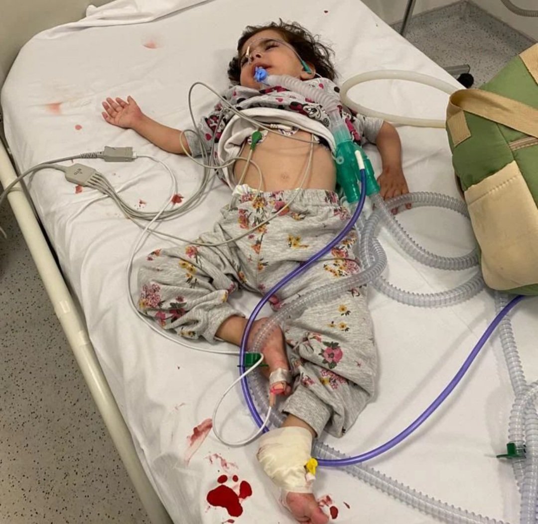 Gücünüz neye yetiyorsa bağış yaparak,twet atarak ya da rt yaparak Asenat'ı bu kablolardan kurtarıp oyuncaklarıyla oynamasını sağlayabilirsiniz 
Lütfen görmezden gelmeyin..

TR88 0001 0023 3477 7059 5450 05
Alıcı:Melik Münas/Ziraat Bankası
Açıklama:Asenat
taplink.cc/asenataumutol