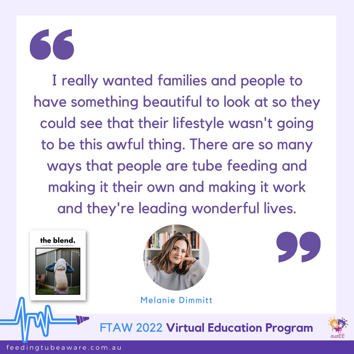 ausEE Inc. (@auseeorg) on Twitter photo A reminder that all the videos from our free virtual education program held during #FTAW2022 are available on our website for on-demand viewing.
If you missed the videos from day one, Bella Gray interviewed <a href="/MelanieDimmitt/">Melanie Dimmitt</a> about #TheBlendMag. Watch here: feedingtubeaware.com.au/virtualeducati… A reminder that all the videos from our free virtual education program held during #FTAW2022 are available on our website for on-demand viewing.
If you missed the videos from day one, Bella Gray interviewed <a href="/MelanieDimmitt/">Melanie Dimmitt</a> about #TheBlendMag. Watch here: feedingtubeaware.com.au/virtualeducati…